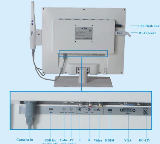 Mlg Best Quality Wilress Dental Intraoral Camera with Ce, FDA