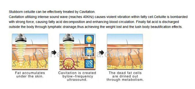 Body Slimming Cavitation RF Vacuum