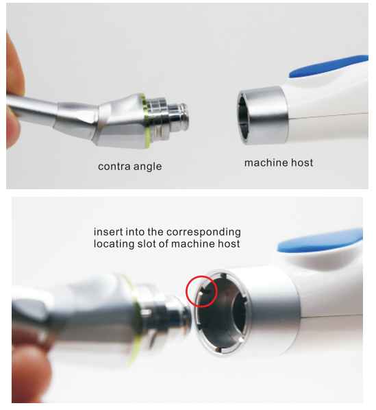 Wonderful Endodontic Treatment Dental Wireless Endo Motor