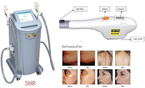 FDA Approved Shr IPL Hair and Acne Scars Removal IPL