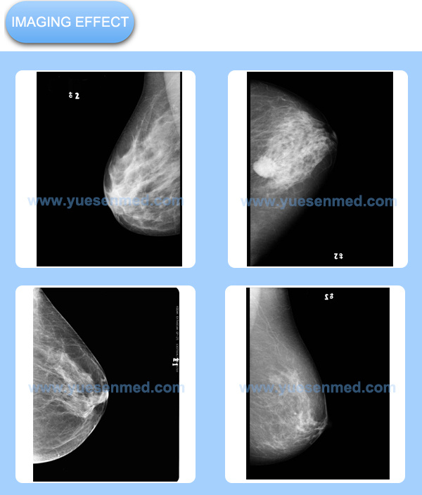 Ysx980d Hospital Medical 3.6kw Mammography X-ray Machine