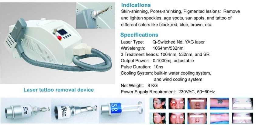 Wholesale Q-Switch ND YAG Laser Machine Tattoo Removal