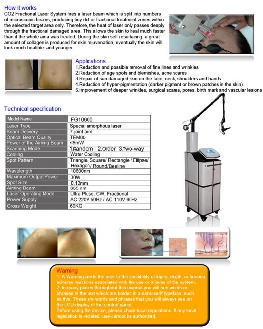 Vaginal Rejuvenation Fractional CO2 Laser