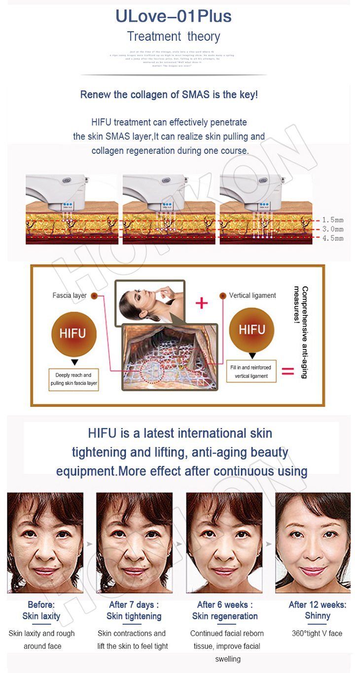 9 Treatment Heads! ! ! Hifu Skin Tighten Ultrasonic Medical Salon Machine