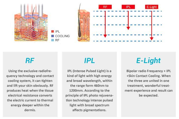 IPL Shr YAG Laser for Hair Removal and Tattoo Removal