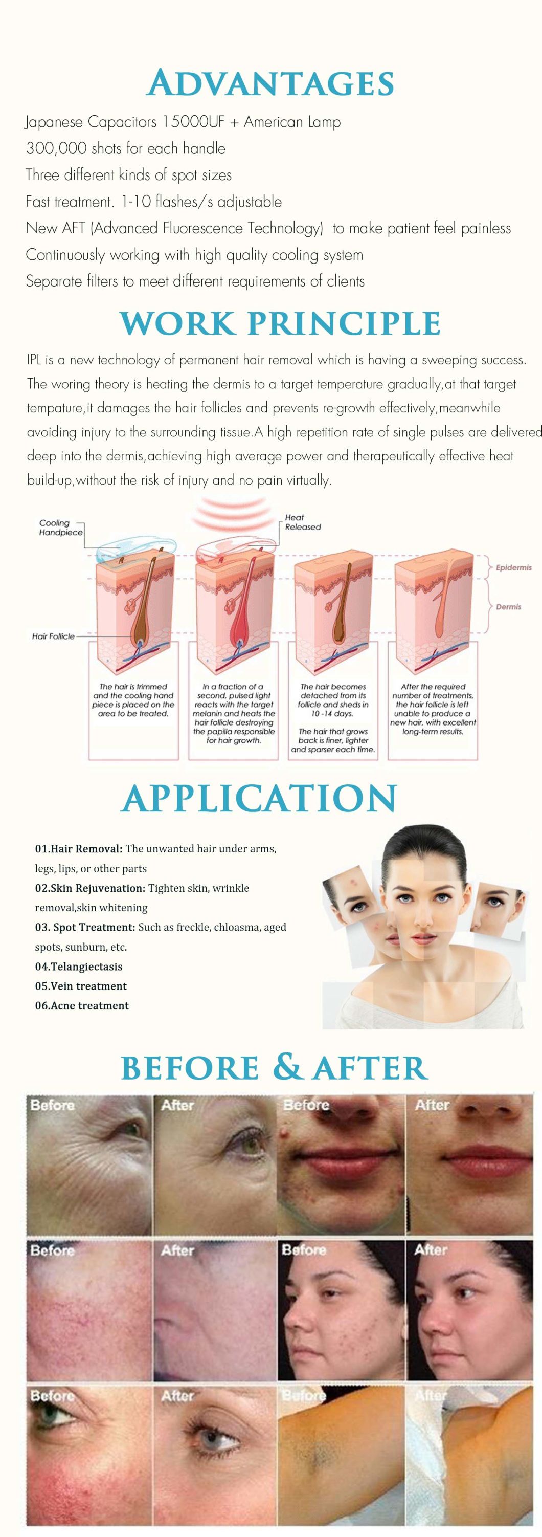 Portable IPL+RF Skin Rejuvenation E-Light Hair Removal Equipment