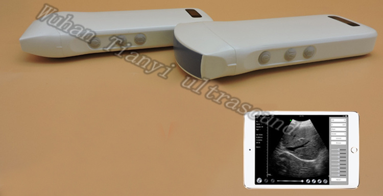 Manufacturer Wireless Ultrasound Scanner for iPhone iPad Smartphone