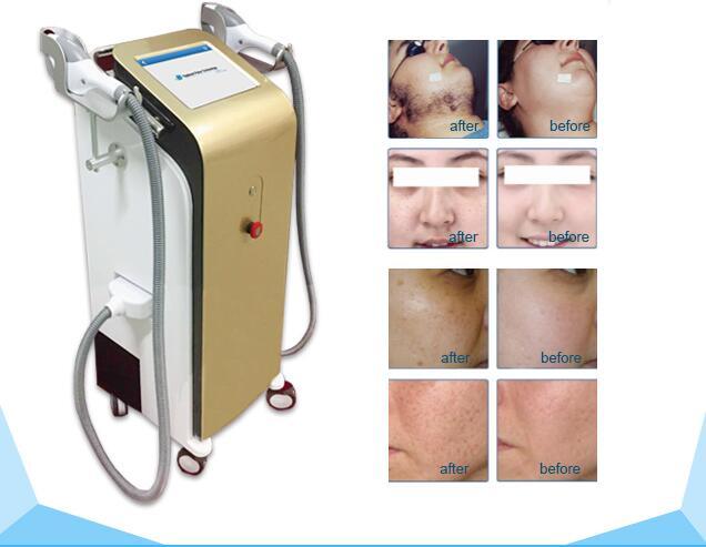 2017 Hot Sale Multifunction IPL Hair Removal Machine