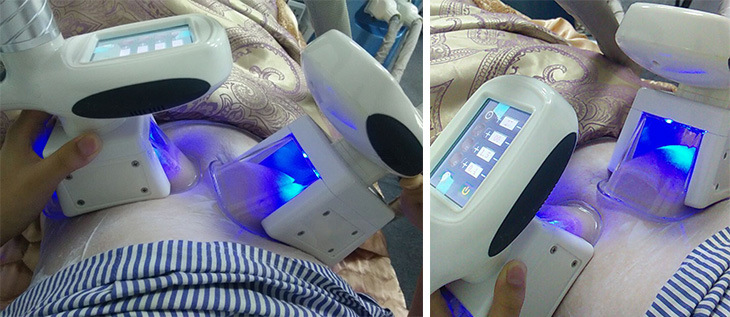 3 N 1 40K Cavitation and RF Weight Loss /Body Slimming Beauty Machine