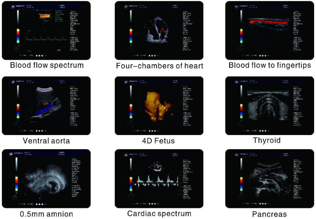 Hospital Diagnostic Machine Full Digital 4D Color Doppler Ultrasound Scanner FM-580c