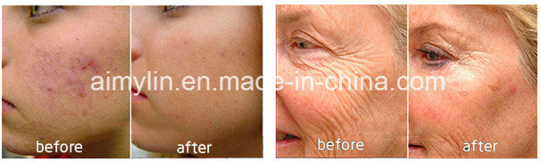 Multifunction Oxygen Jet Peel Facial Skin Care Oxygen Spray Infusion Oxygen Mask Bio Face Lifting