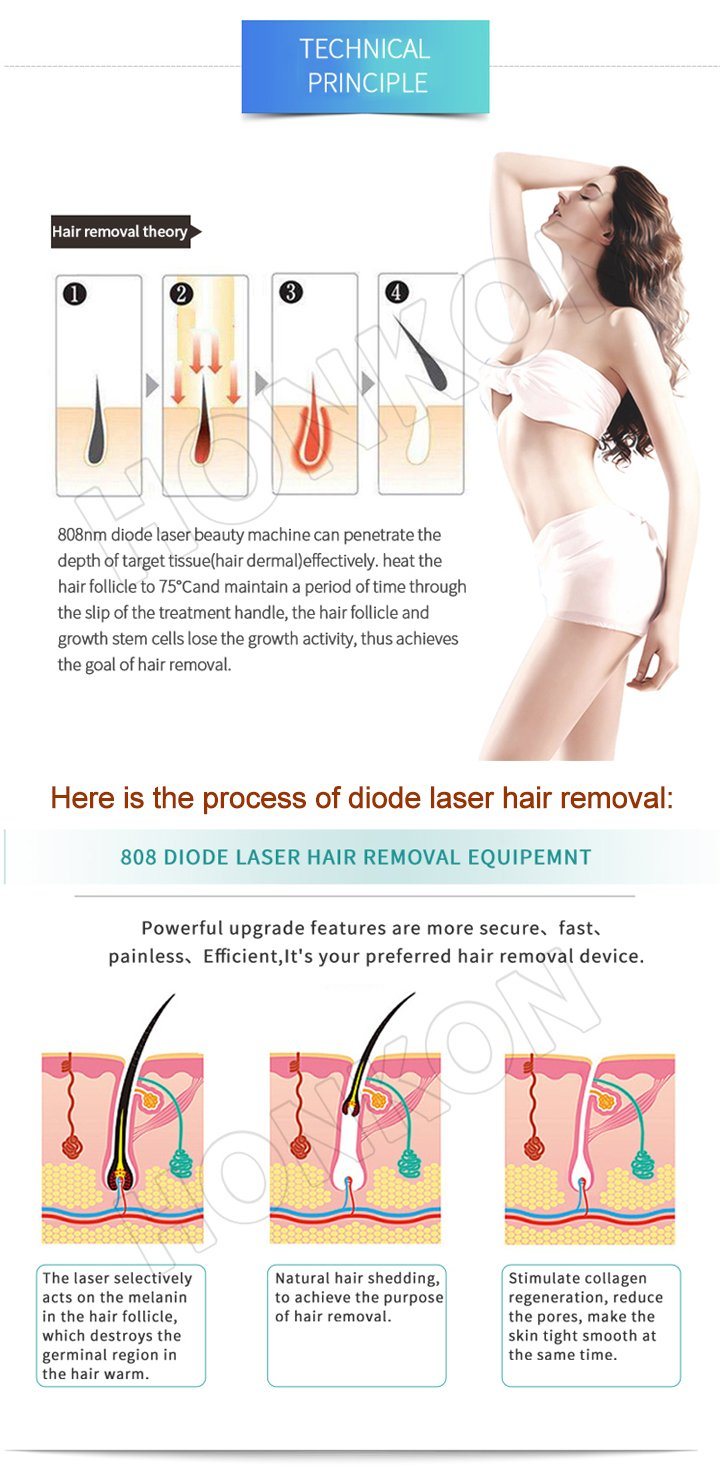Professional Permanent 808nm Diode Laser Hair Removal System Beauty Machine