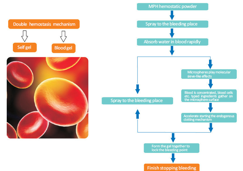 a New Hemostatic Agent When Endoscopy