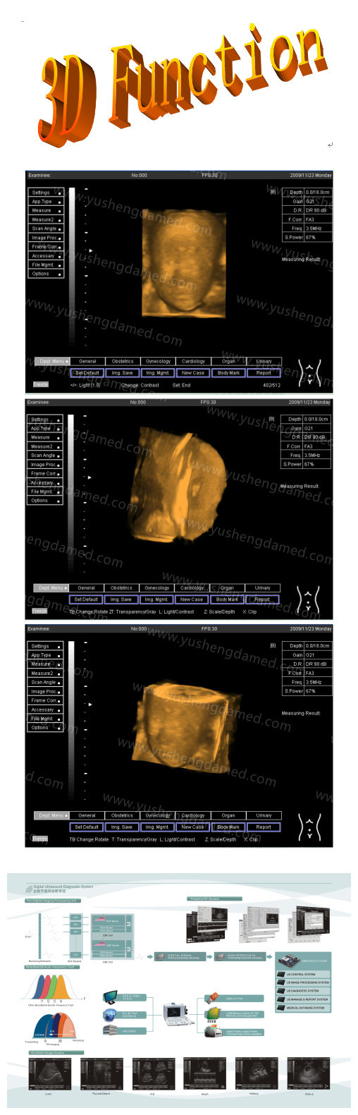 Ce Medical Diagnostic Obstetrics PC Based Digital Portable Ultrasound Scanner