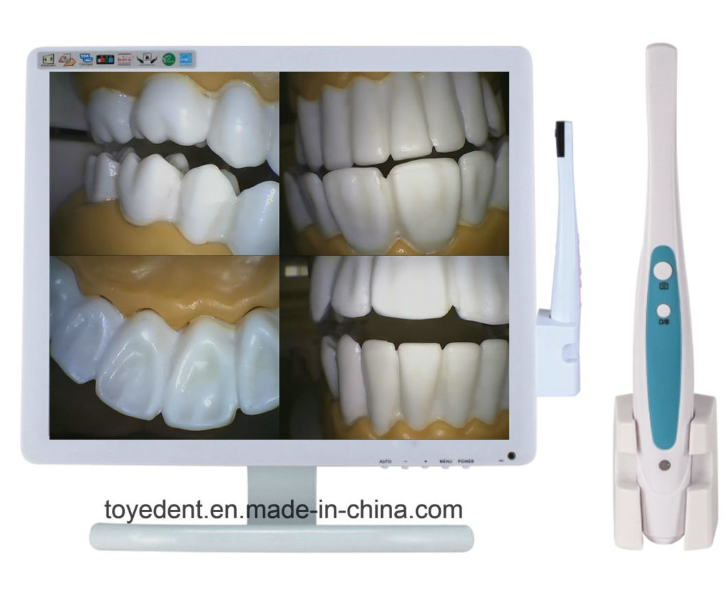 500.0000 Mega Pixels Dental Intra Oral Camera with 17 Inch LCD Monitor