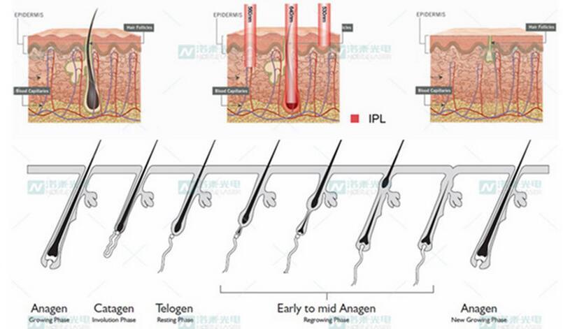 Home Use IPL Beauty Equipment