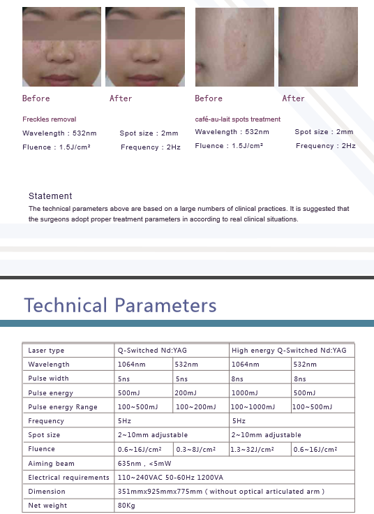 Picosecond Q Swithed ND YAG Laser with FDA Approved