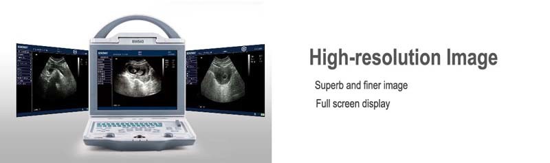 4D Ultrasound, What's The Price for 4D Ultrasound, Full Digital Portable Ultrasound (BW540)