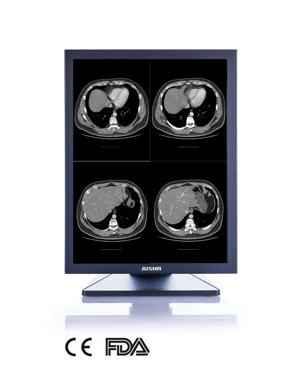 3MP 21-Inch 2048X1536 LED Screen Monochrome Monitor, CE, FDA Approved, Digital Dental X Ray Equipment