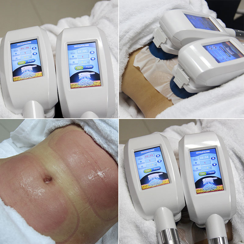 Cool Advantage Cryolipolysis Handles Cool Sculpting Fat Freezing Body Slimming Machine