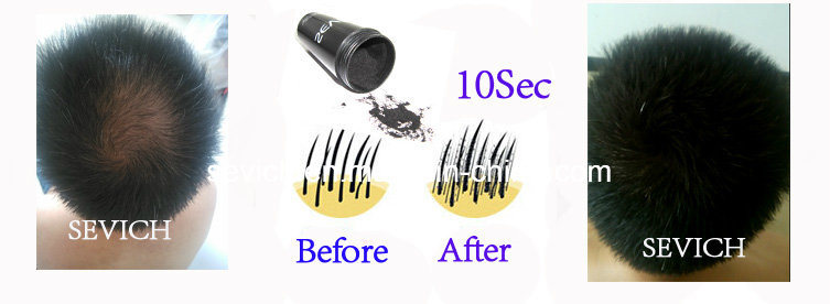 Easy Using Hot Sales Products Hair Growth Hair Fiber Products