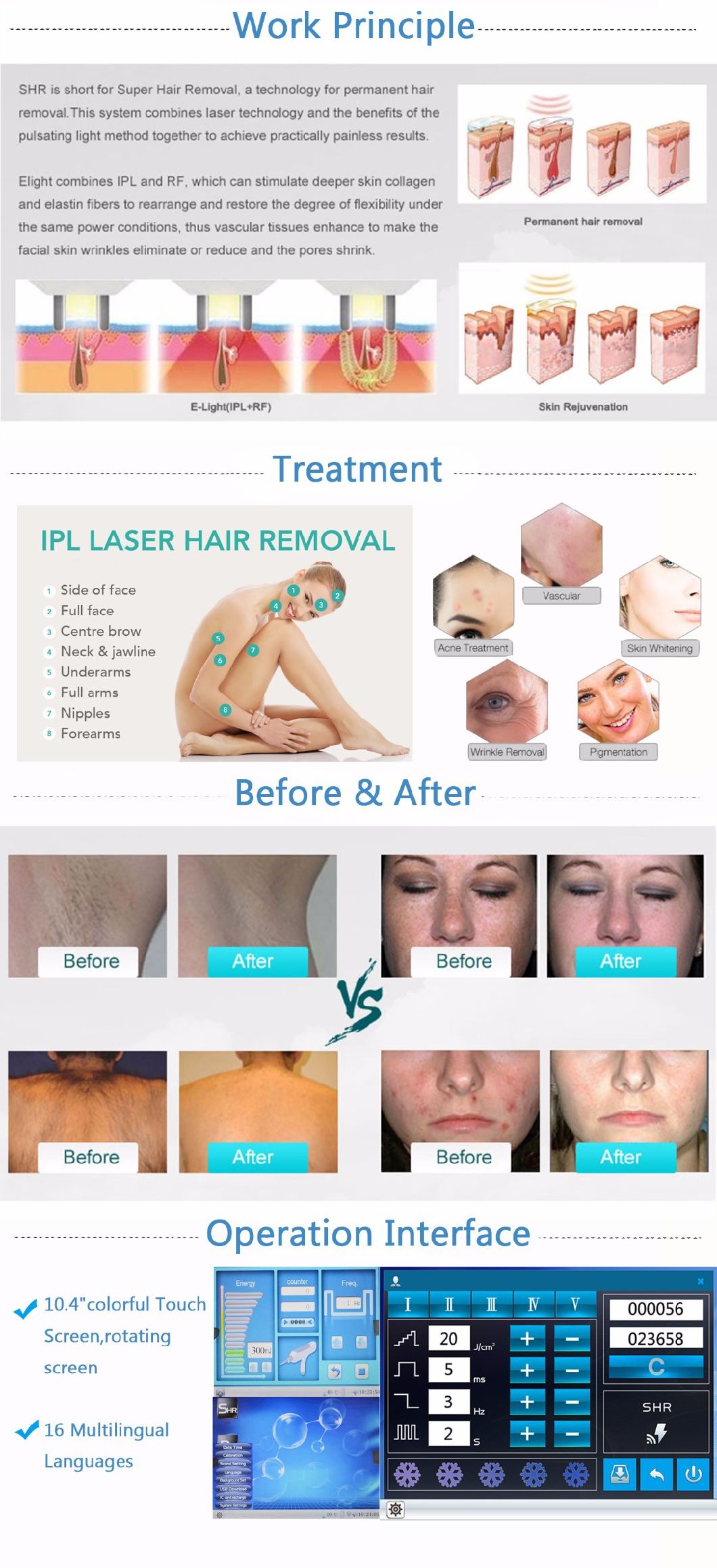 IPL +RF +Laser 3 in 1 Hair & Wrinkle Removal Machine