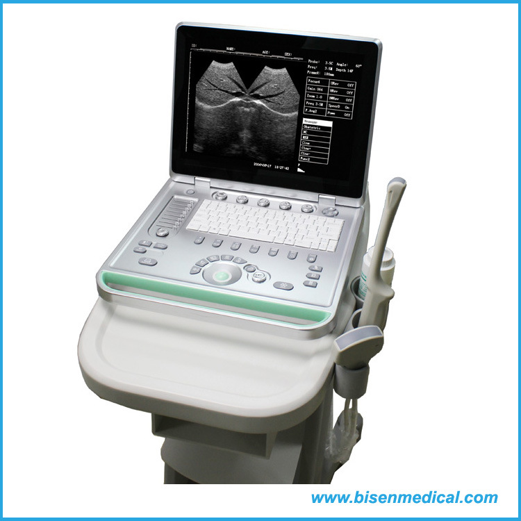 BS-Ss-7 15 Inch High Definition LED Screen Handheld Ultrasound Scanner Machine with Built-in Battery