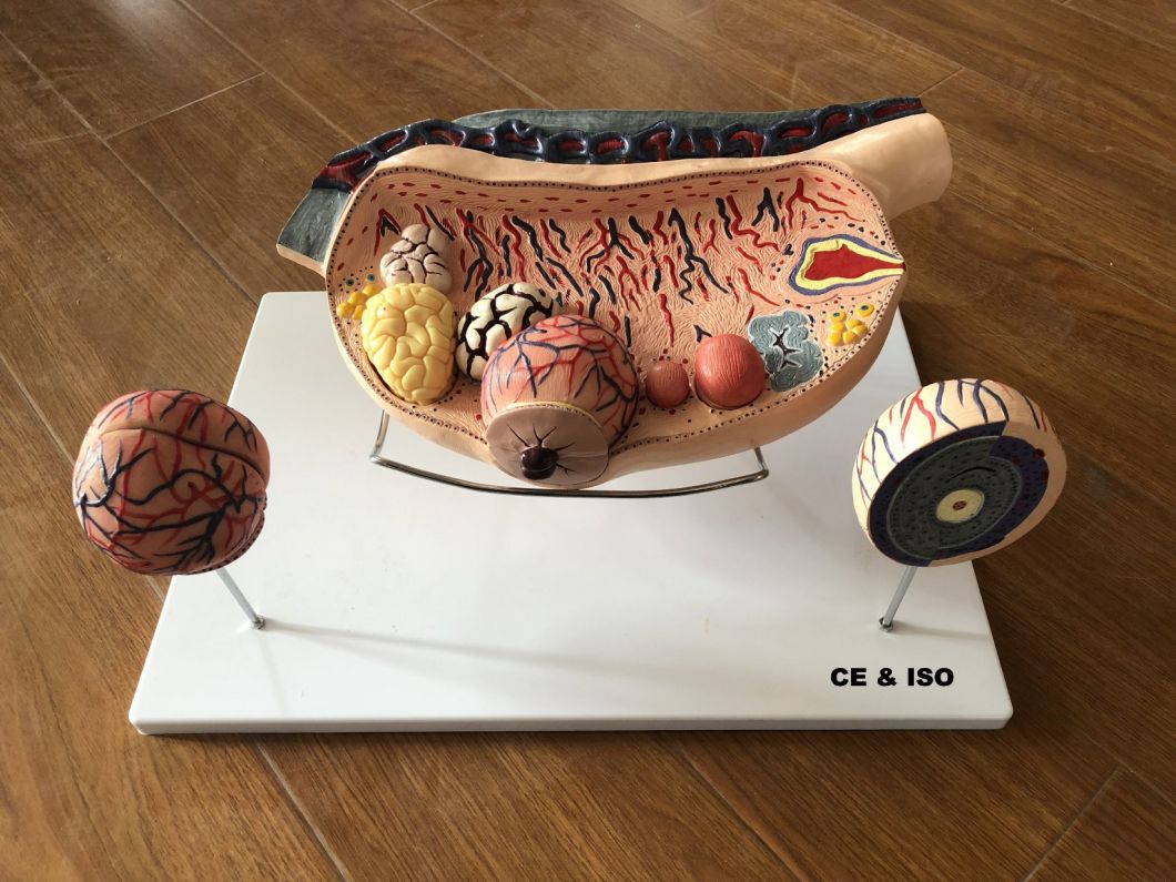 High Enlarged Ovary, Anatomical Model, Teaching Models