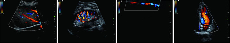 Color Doppler Medical Equipment, Diagnostic Imaging System, Radiography, Sonography