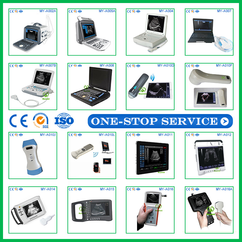 High Quality Medical Ultrasonic Diagnostic Equipment Digital B Ultrasound Machine Price Ultrasound Scanner