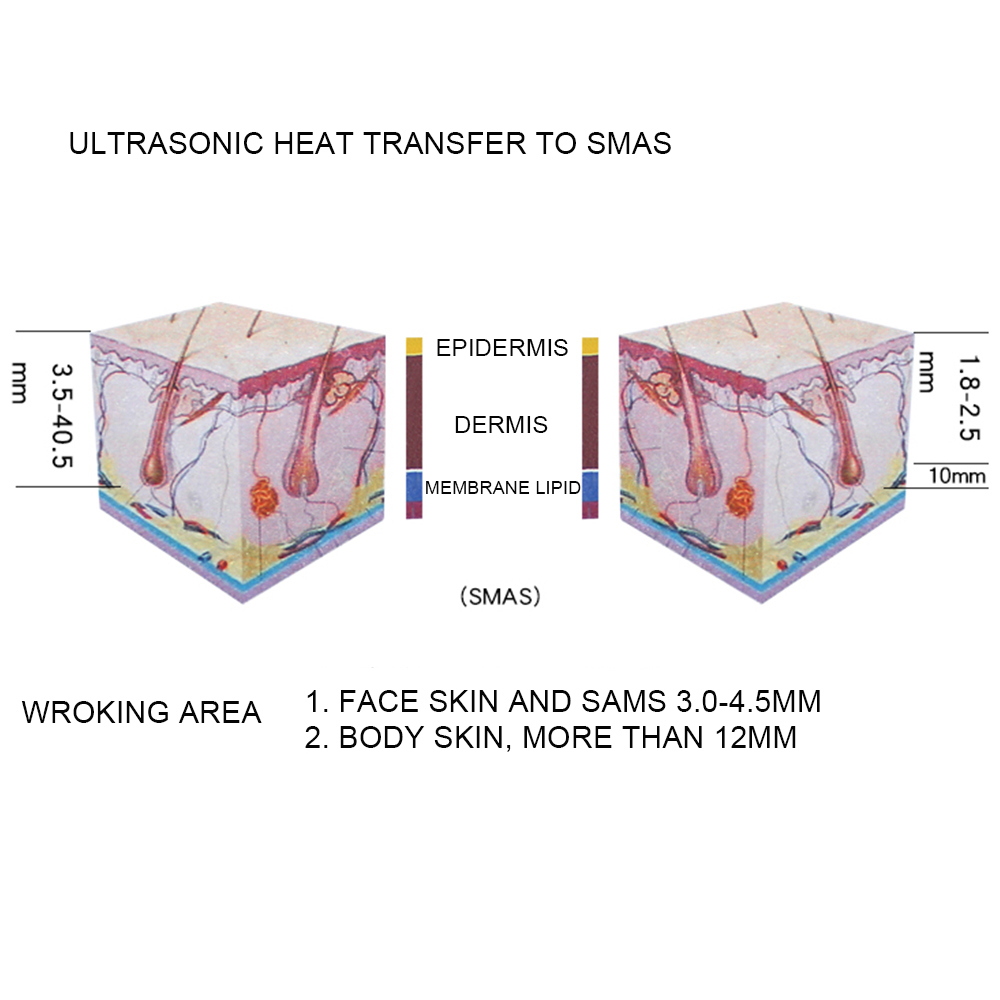 RF and Cavitation for Face and Body