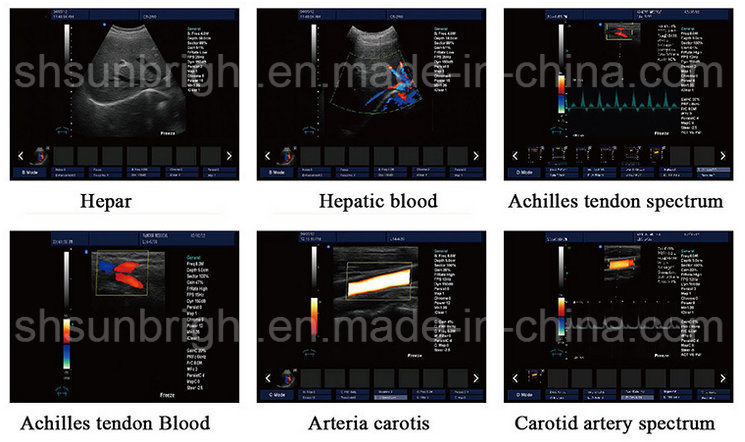 High Accurancy Eco Sonography Color Doppler for Vascular Fetal