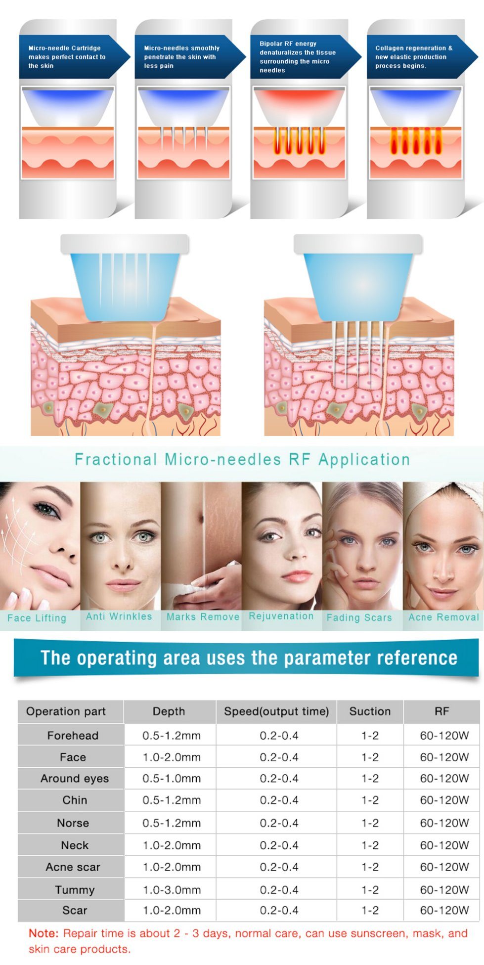 New RF Face Lifting Beauty Machine (Microneedle/Fractional RF)
