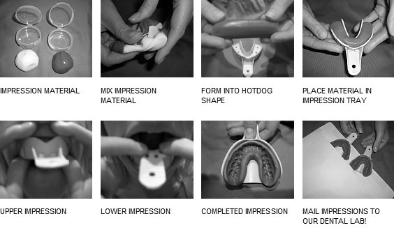 Orthodontics Teeth Impression Silicone Materials Putty