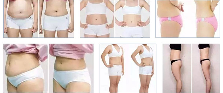 Portable Medical Hifu Body Shape and Body Slimming Liposonix Beauty Machine for Sale