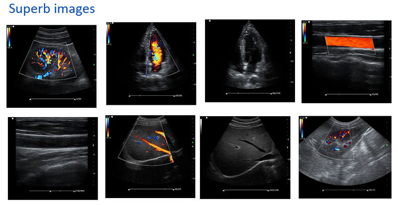 Full Digital Portable Color Doppler Diagnostic Ultrasound Imaging with Cw, Intima Measurement Imt, Phased Array Probe, 15 Inch LCD Display