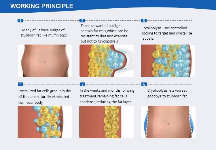 Zeltiq Cool Sculpting Criolipolise Lipofreeze Machine