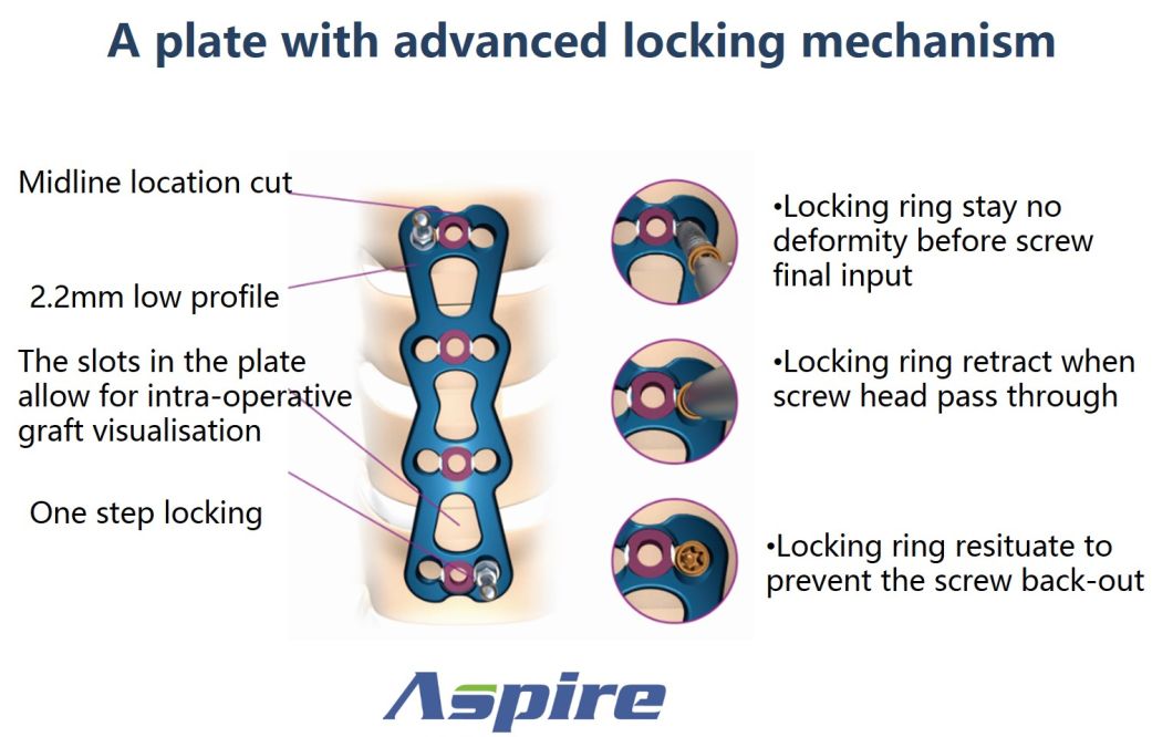 Self-Tapping Variable-Angle Screw of Spine Fixation System