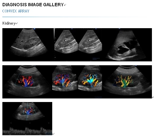 Ce, FDA Approved 4D Color Doppler Ispark 480