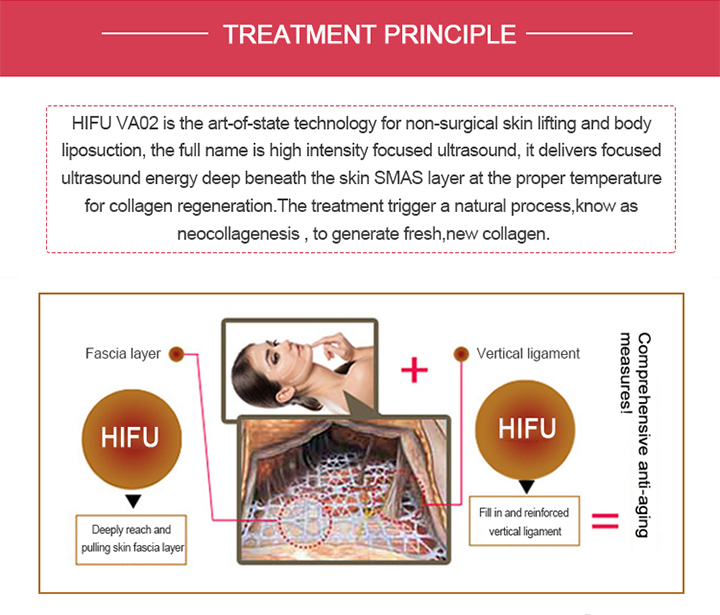 Hifu Anti-Aging Skin Rejuvenation Face Lift RF Anti-Wrinkle Equipment