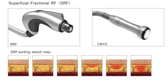 Fractional RF Facial Cleanser /Body Skin Care Beauty Machine (MR18-2S)