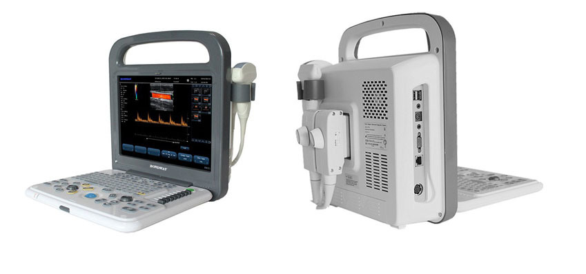 Ultrasound Portable Fetus Color Doppler, Es240, Ultrasound Machine, Doppler Ultrasound Equipmnet