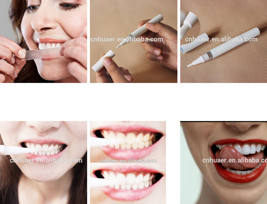 Home Teeth Whitening Strips and Pen Kit Whitening System