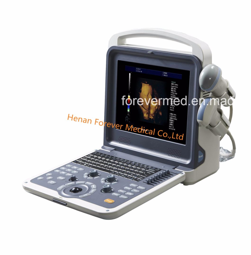 LED Color Doppler Cardiac Gynecology Ultrasound Ultrasonography