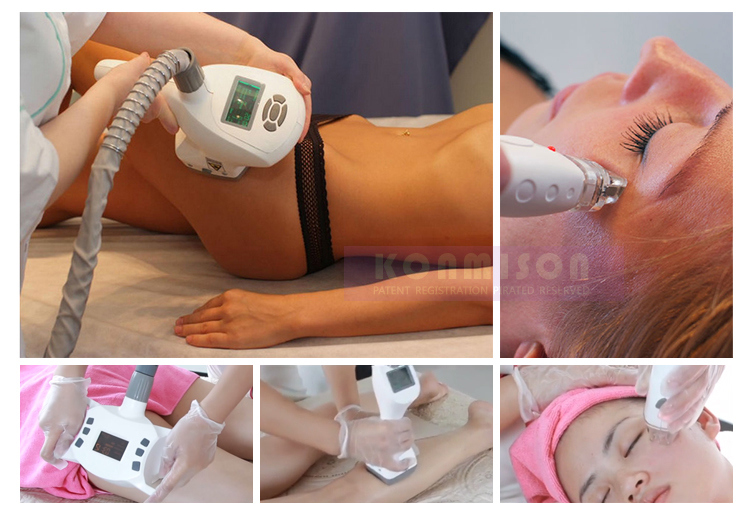 V8c1 Body Slimming Machine Velashape for Weight Loss Skin Tightening