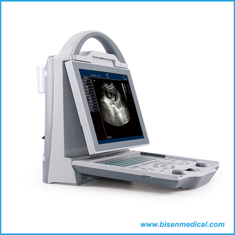 BS-5600 Portable 3D Black White Ultrasound Scanner Machine with Great Price