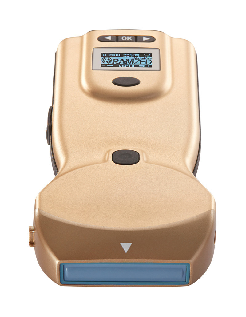 Ce Wireless Color Doppler Ultrasound Scanner Hospital Equipment