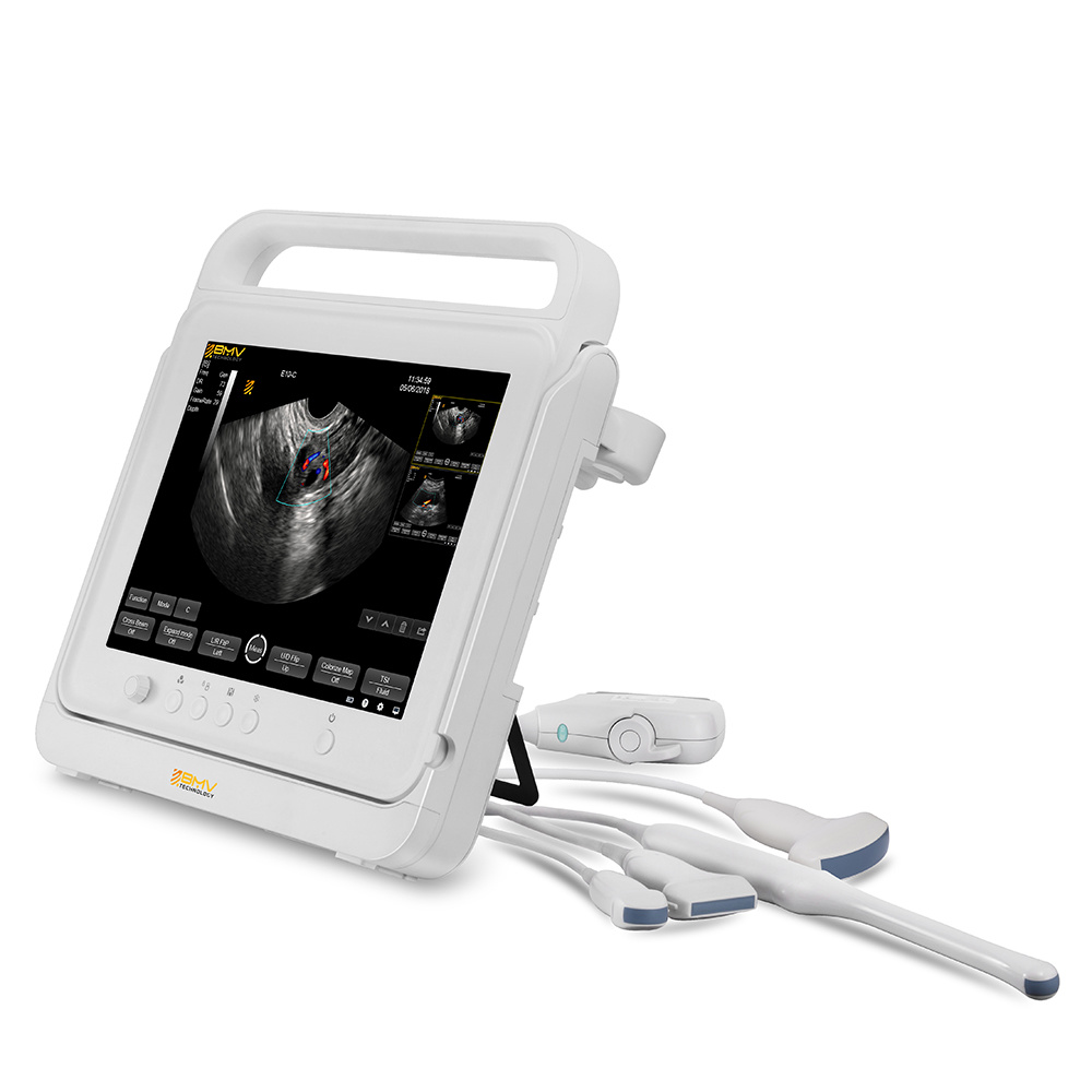 Medical Instrument Color Doppler Laptop Ultrasound Scanner