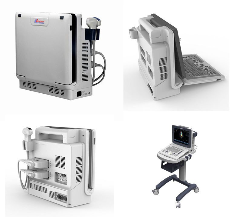 Digital Portable Color Doppler Ultrasonic Scan Machine, USG, Color Doppler Ultrasound Scanner, Sonography