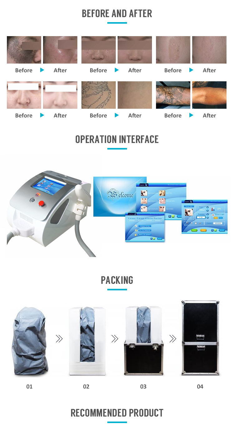 1064/532/1320nm Q Switch ND YAG Laser Tattoo Removal